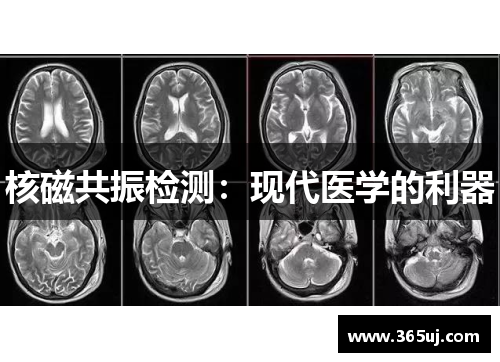 核磁共振检测：现代医学的利器
